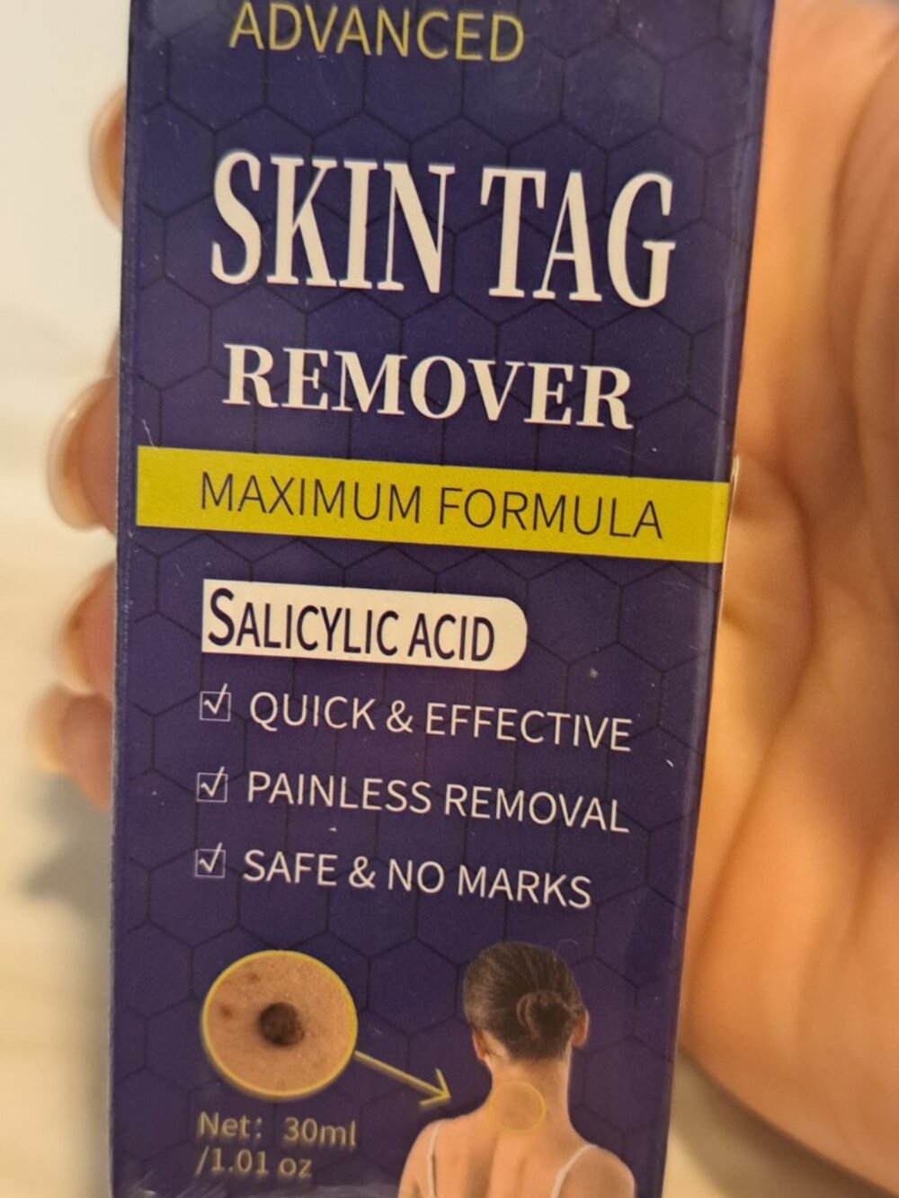 ZRIZL Advanced Skin Tag Remover with Salicylic Acid-MAXIMUM FORMULA
